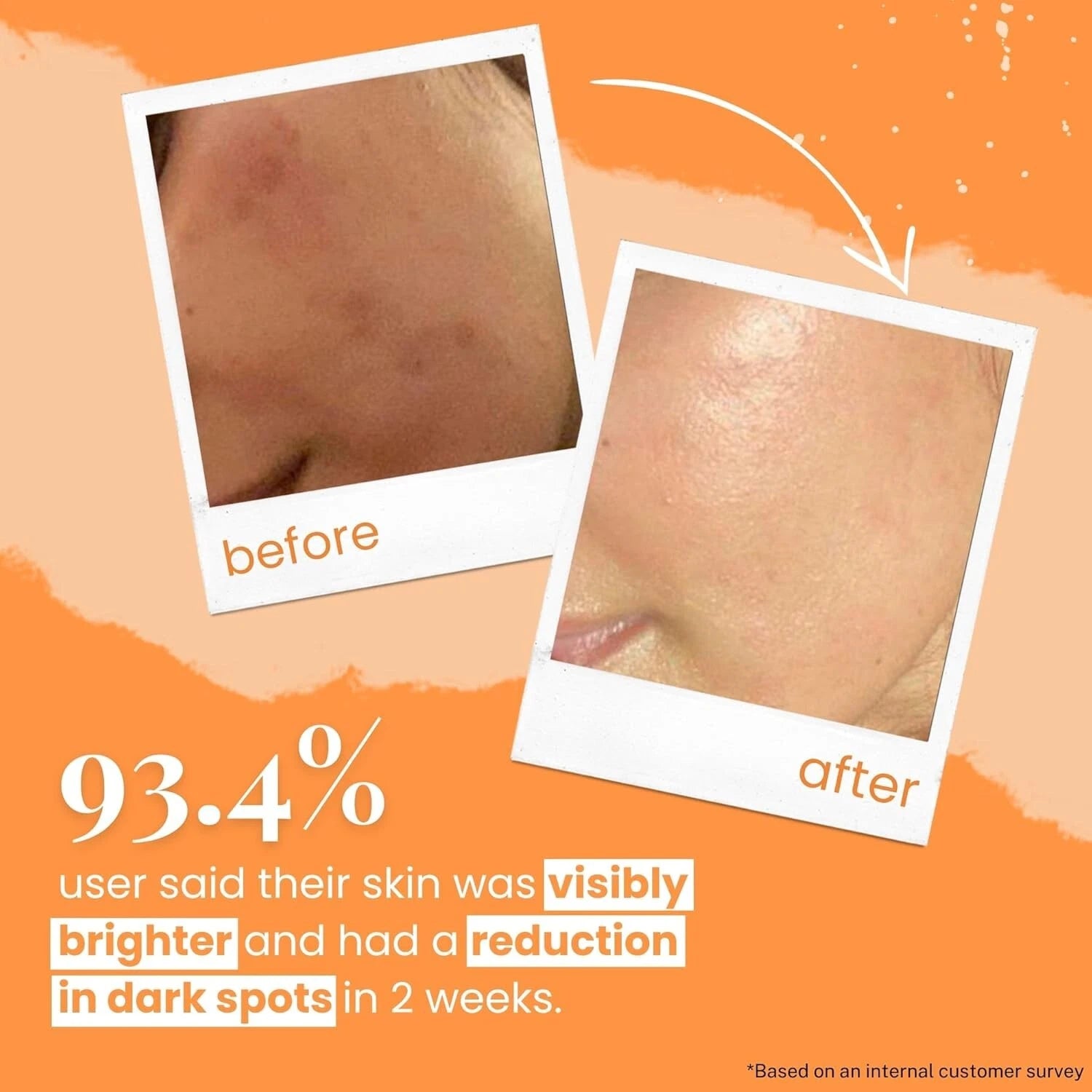 Little Extra Rice Berry 10% Vitamin C Face Serum for Glowing 30ml